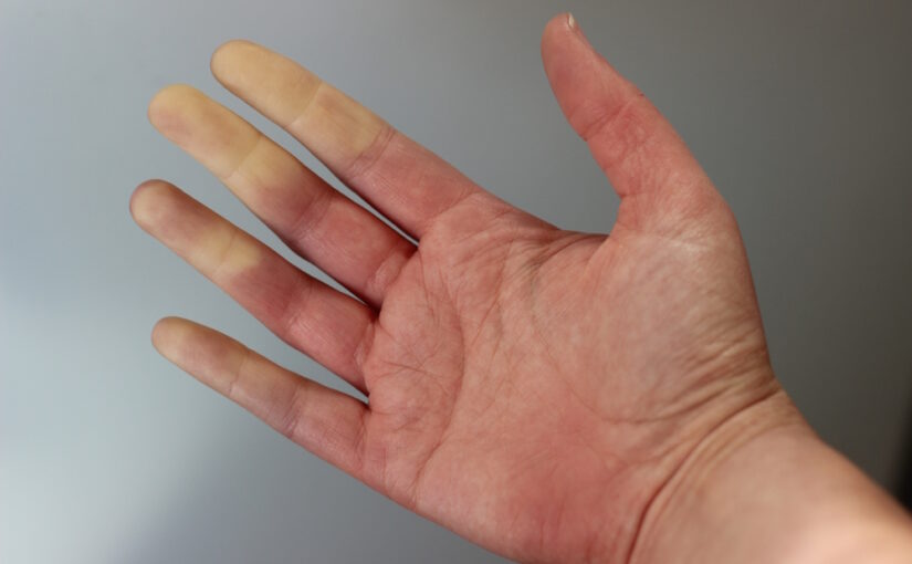 Hand Arm Vibration Risk Assessments
